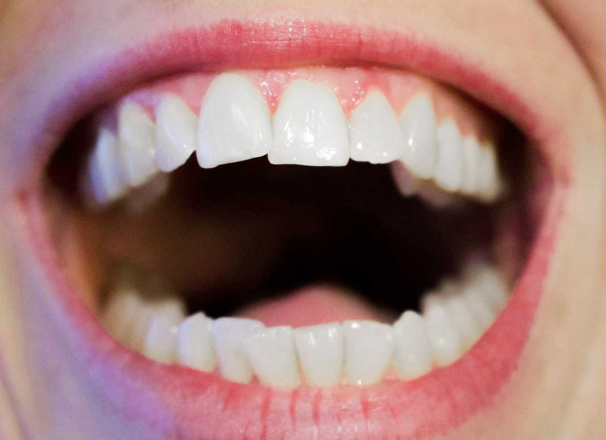 Zahnprothese richtig pflegen